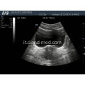 Prezzo macchina ad ultrasuoni portatile scanner ad ultrasuoni digitale